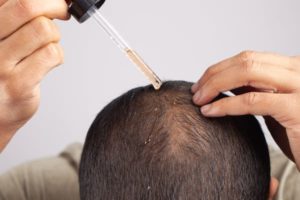 Minoxidil topical on hairs