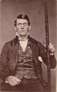 Cabinet-card portrait of brain-injury survivor Phineas Gage (1823–1860), shown holding the tamping iron that injured him.Wikimedia