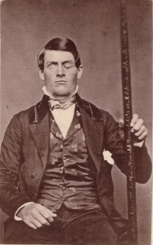 The Enigma of Phineas Gage: A Tale of Tragedy and Neuroscience.